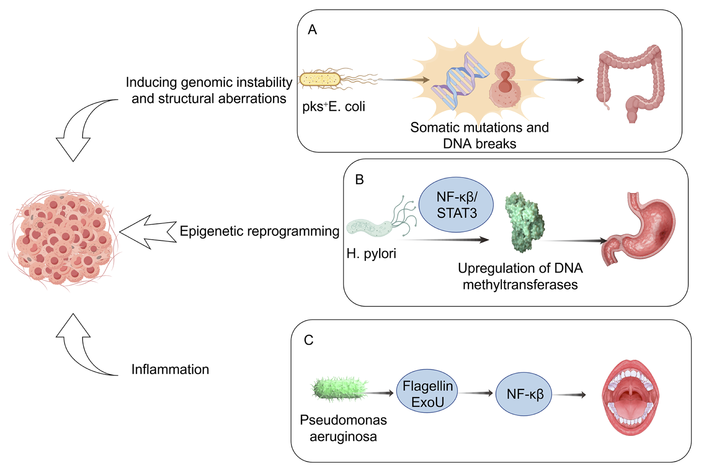 Mechanistic pathways linking the microbiome to cancer development. This schematic summarizes the principal mechanisms through which microbial dysbiosis promotes carcinogenesis. 
